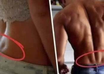 What Does It Mean If You Have Those Two Dimples On Your Lower Back?