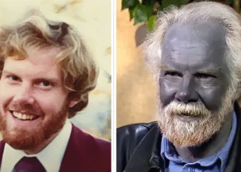 The Heartbreaking Story of a Man Who Became Permanently Blue