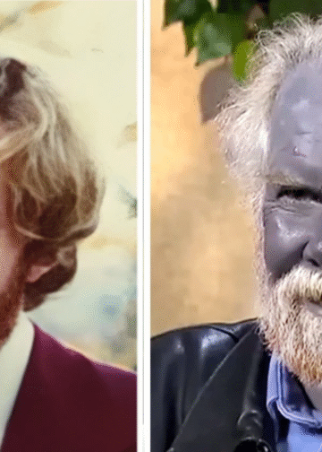 The Heartbreaking Story of a Man Who Became Permanently Blue